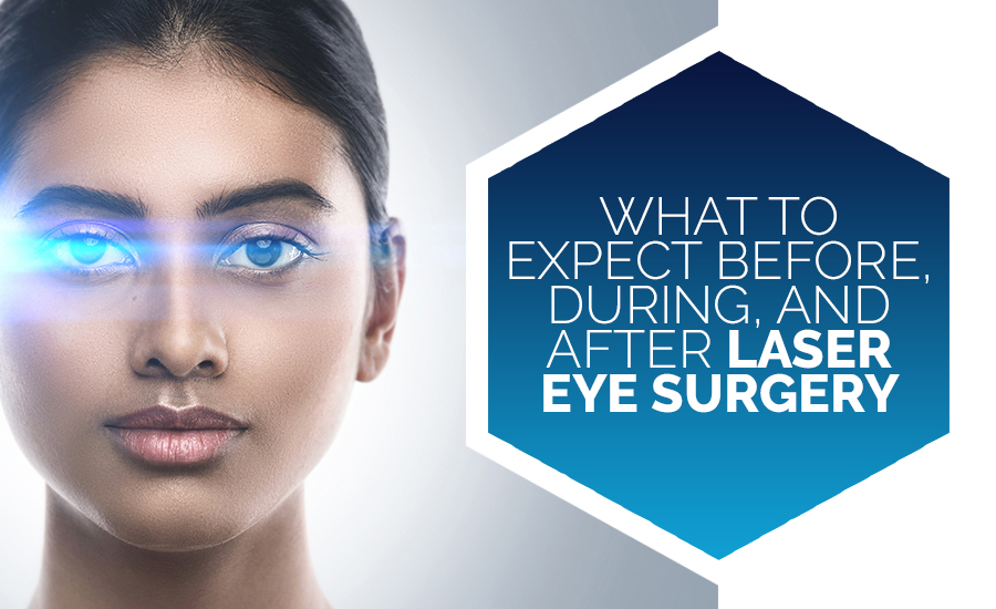 What to Expect Before, During, and After Laser Eye Surgery