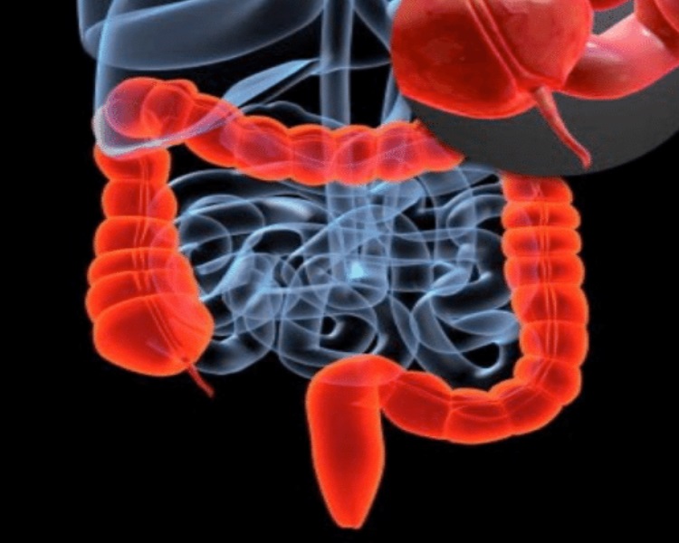 How Does Appendix Operation Work?