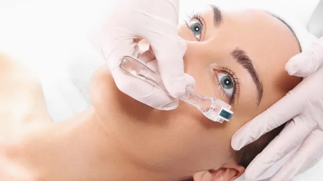 Microneedling: Everything You Need To Know About It