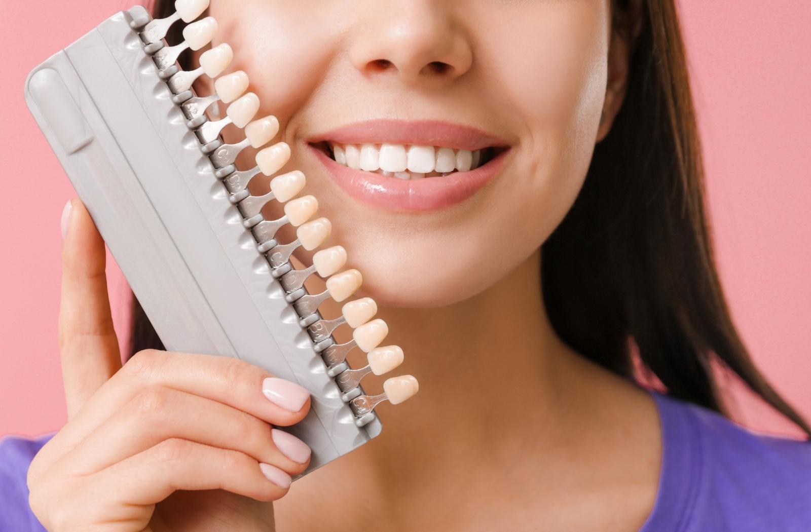 Celebrity Veneers: The Benefits of Having Perfect Teeth!