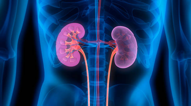 Kidney Relocate Method and Analysis: Current Realities
