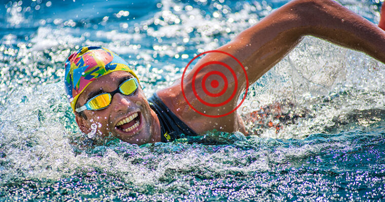 What Can Lead You To Swimming Injuries?