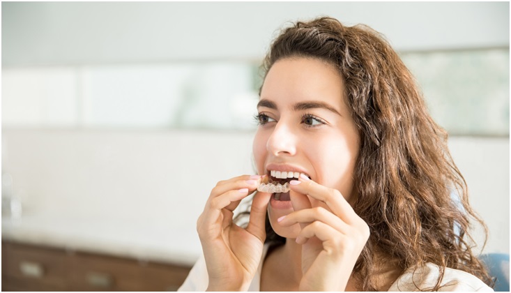 Why Aligners and You are a Perfect Match!
