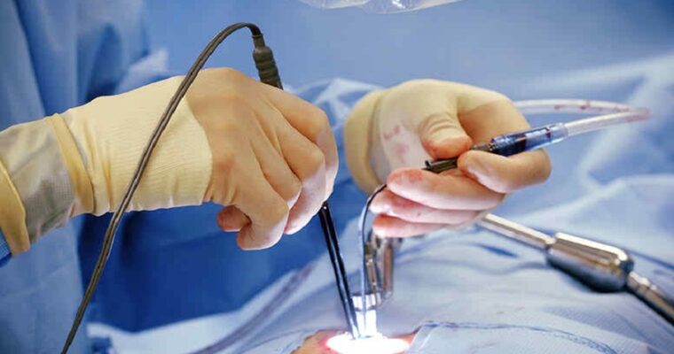 Questions to Ask Your Doctor Before a Minimally Invasive Spine Surgery