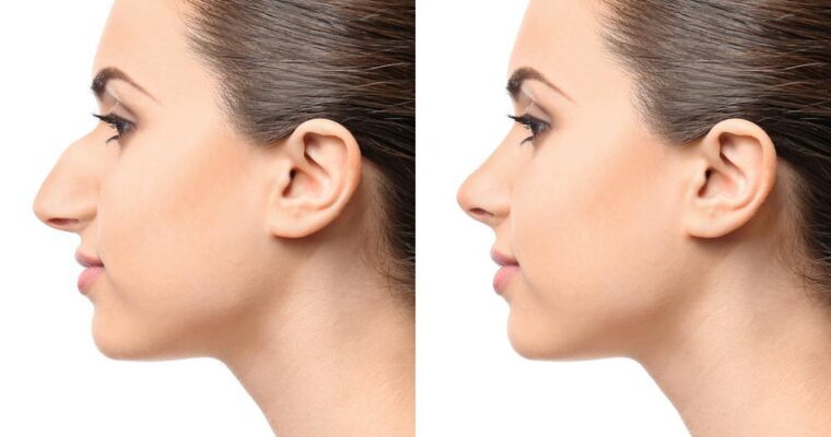 What Are the Best Possible Ways to Treat a Sinus Infection?