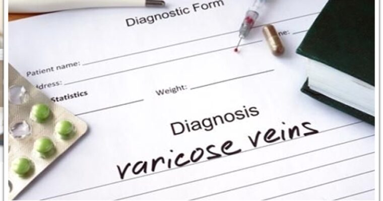 A Concise Guide to Varicose Veins Treatments