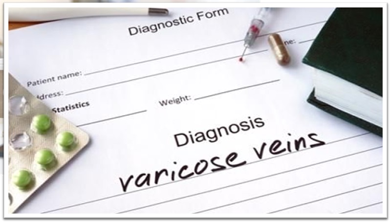 A Concise Guide to Varicose Veins Treatments