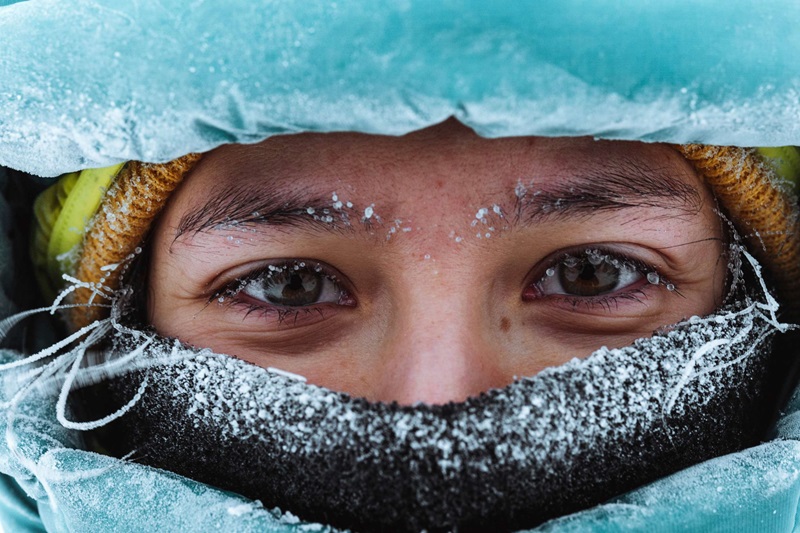 Winter: Does The Cold Affect The Eyes?